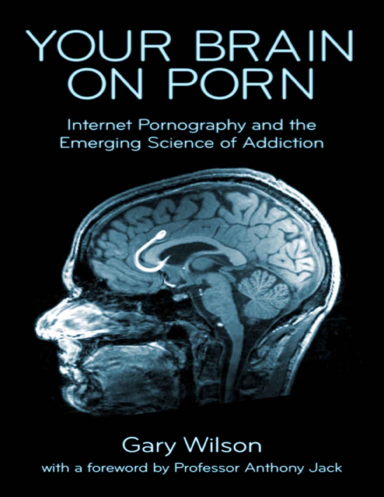 Your Brain on Porn